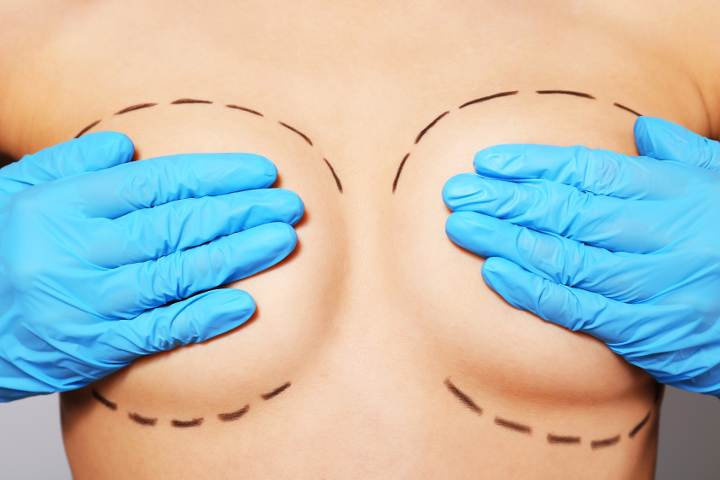 Implantatwechsel Hamburg